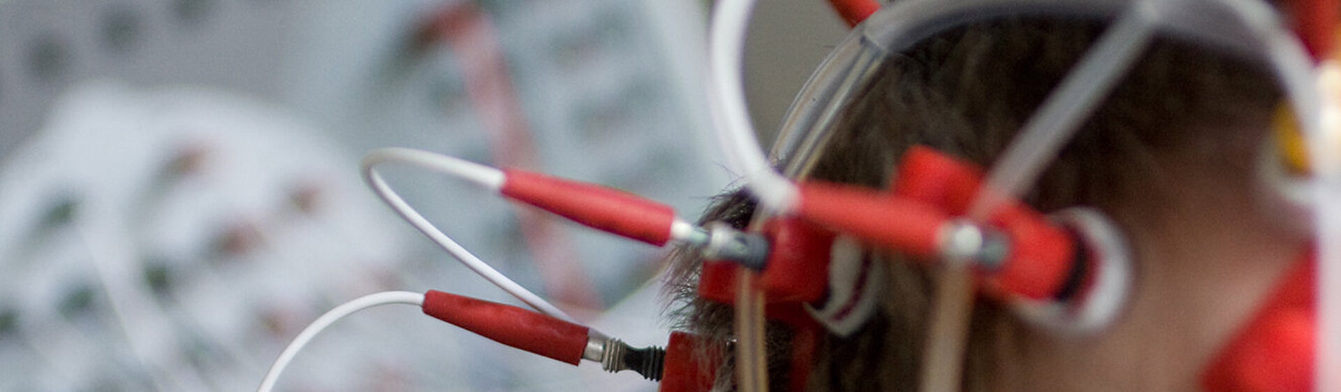 EKG am Kopf EKG am Kopf