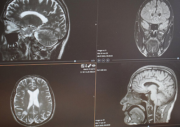 Leistungen der Spezialsprechstunde für Multiple Sklerose Leistungen der Spezialsprechstunde für Multiple Sklerose