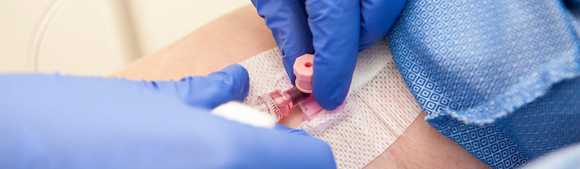 Hände mit blauen Latexhandschuhen legen einen Zugang am Arm für die Infusionstherapie Hände mit blauen Latexhandschuhen legen einen Zugang am Arm für die Infusionstherapie