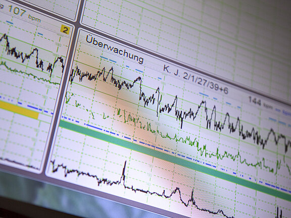 Abbildung eines Überwachungs-EKG.