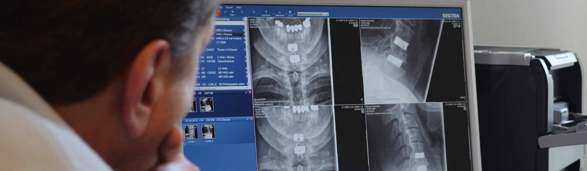MRT-Bilder der Halswirbelsäule werden am Bildschirm beurteilt.