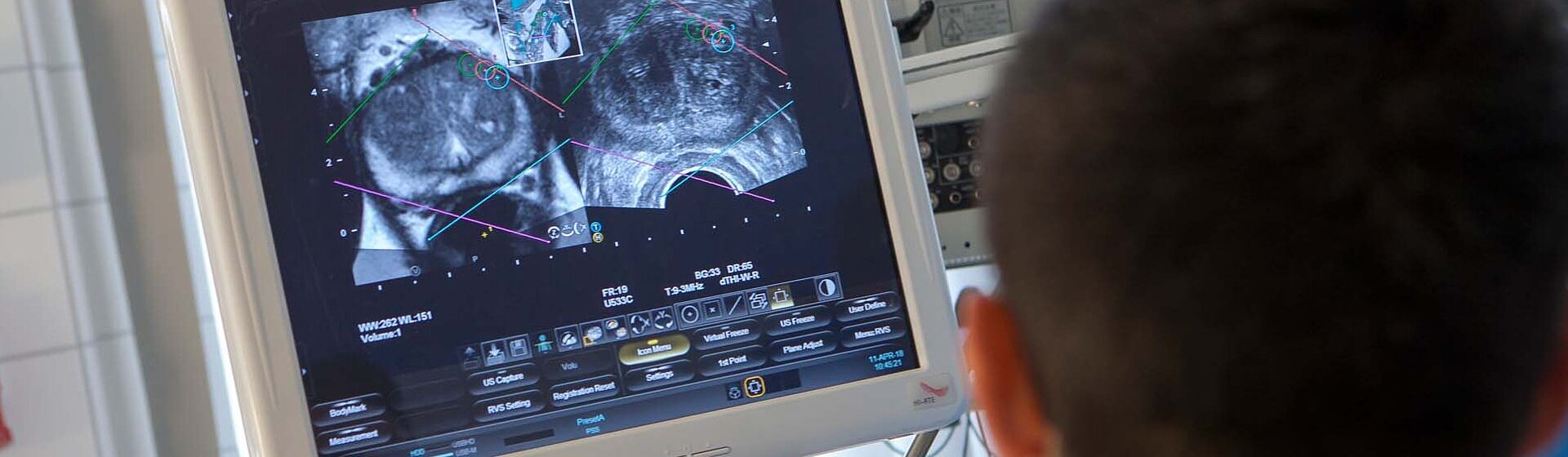 Mediziner schaut Ultraschallbild an