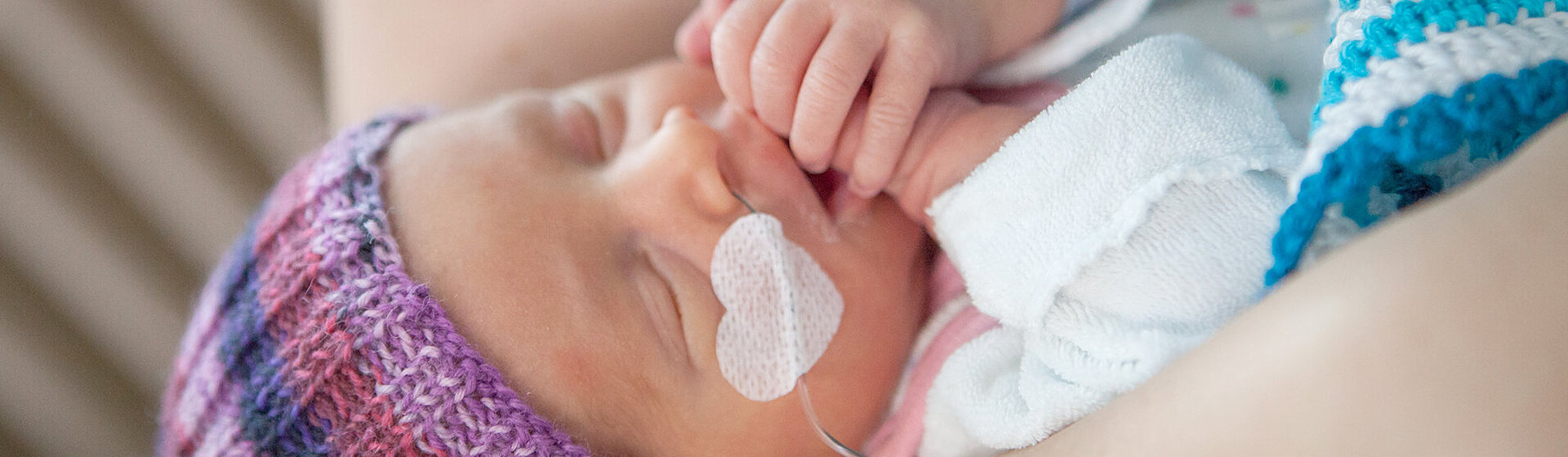 Ein Frühgeborenes mit Beatmungsschlauch in der Nase.