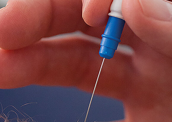 Leistungen der Spezialsprechstunde für Neuromuskuläre Erkrankungen Leistungen der Spezialsprechstunde für Neuromuskuläre Erkrankungen