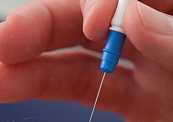 Behandlungsschwerpunkt Nerven- und Muskelerkrankungen