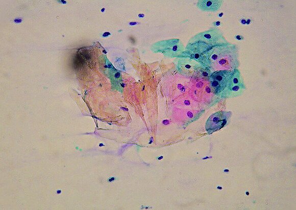 Dysplasiesprechstunde