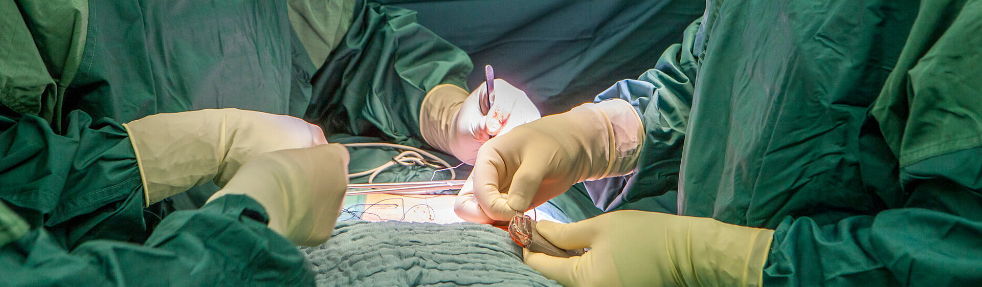 Operateure legen während einer OP ein Elektrode zur Stimulierung der tiefen Rückenmuskulatur. Operateure legen während einer OP ein Elektrode zur Stimulierung der tiefen Rückenmuskulatur.