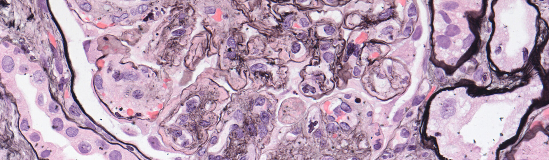 Ein lichtmikroskopisches Bild eines Nierenkörperchens, es stellt die kleinste funktionelle Filtrationseinheit der Niere dar. 