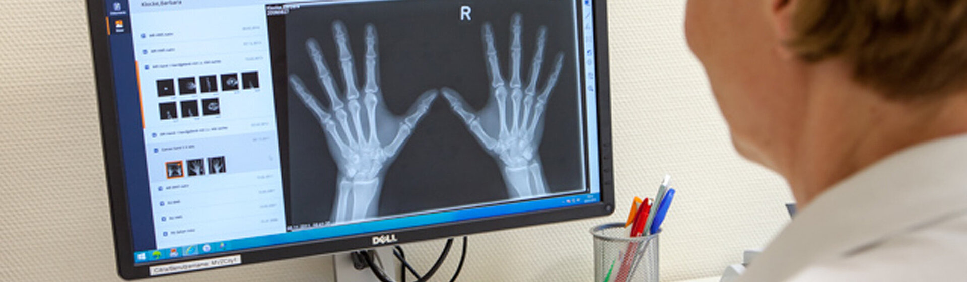 Betrachtung einer Röntgenaufnahme der Hände an einem Monitor.