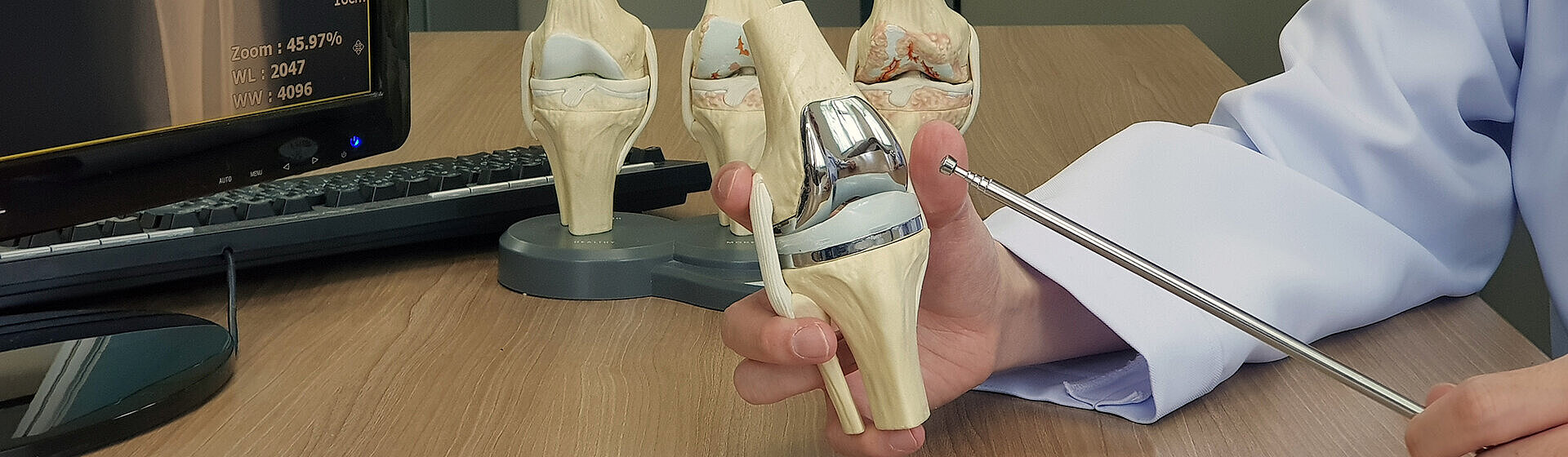 Mediziner hält ein Modell vom Kniegelenk in der Hand. Mediziner hält ein Modell vom Kniegelenk in der Hand.