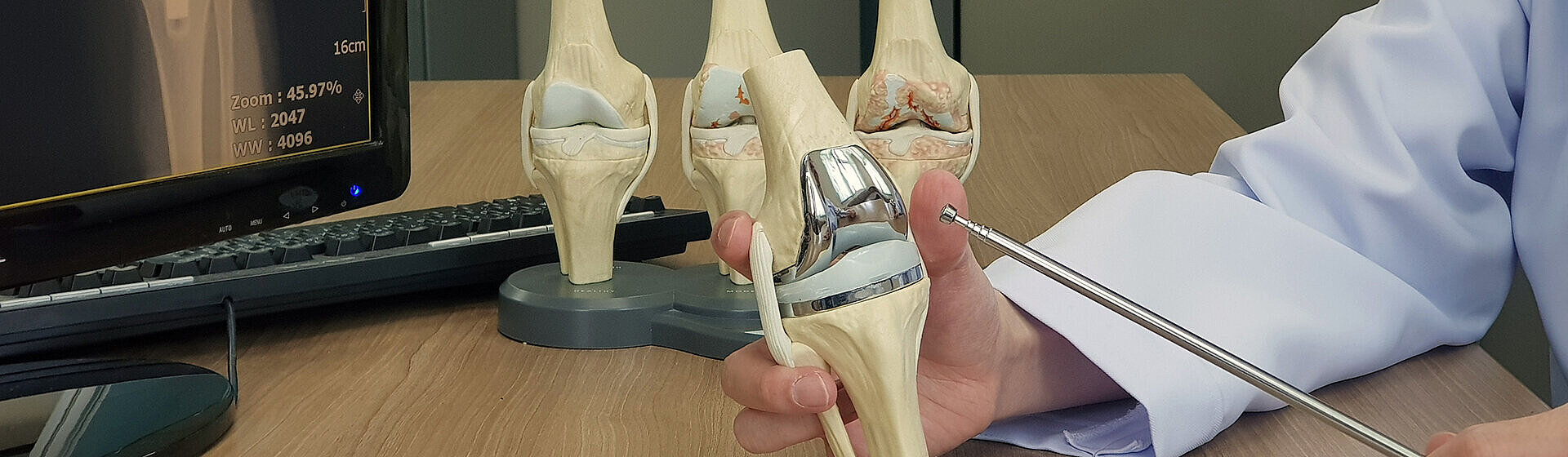 Mediziner hält ein Modell vom Kniegelenk in der Hand.