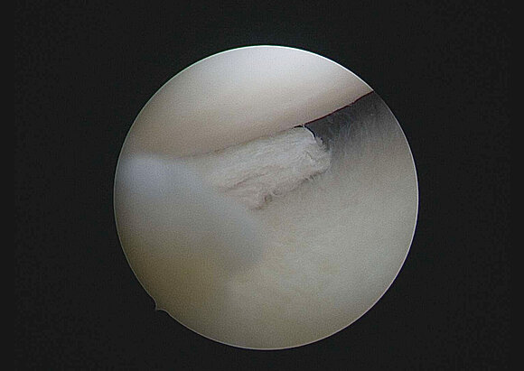 Behandlungsschwerpunkt Arthroskopie