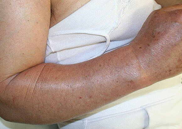 Behandlungsschwerpunkt Infektbehandlung