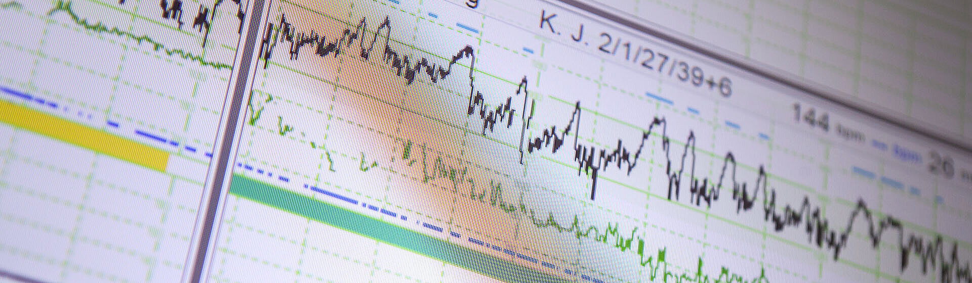 Abbildung eines Überwachungs-EKG.