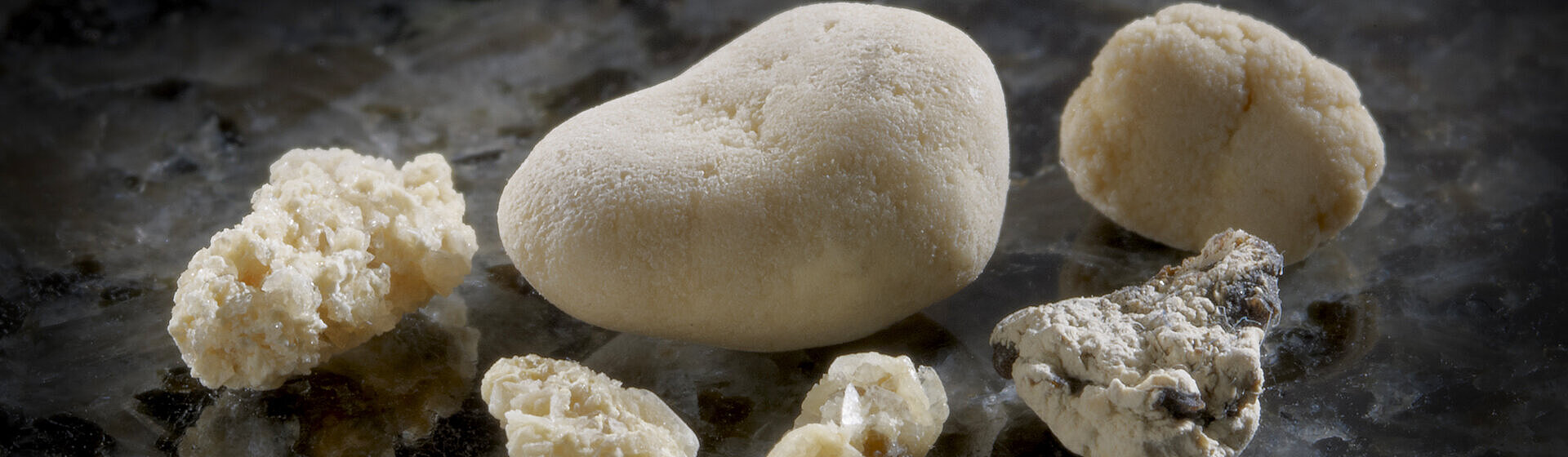 Sechs Harnsteine in verschiedenen Größen