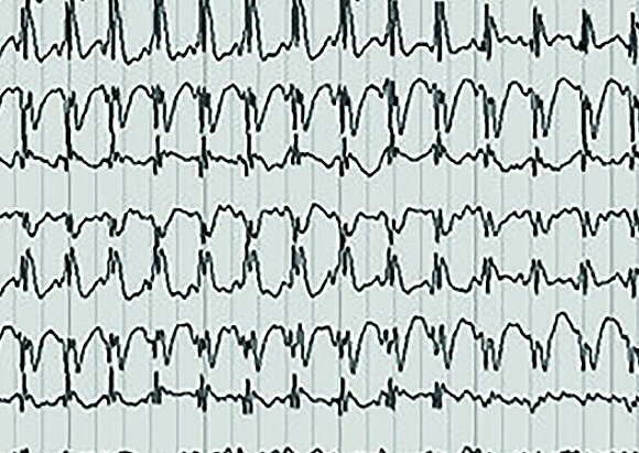 Leistungen der Spezialsprechstunde für Epilepsie Leistungen der Spezialsprechstunde für Epilepsie
