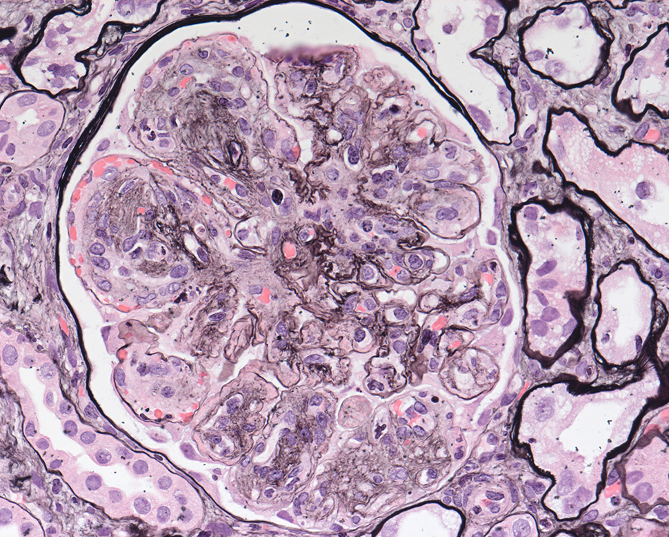 Behandlungsschwerpunkt Nephrologie
